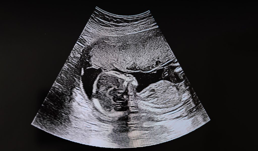 It is no surprise that the public is worried about maternity care