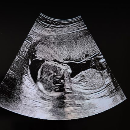 It is no surprise that the public is worried about maternity care